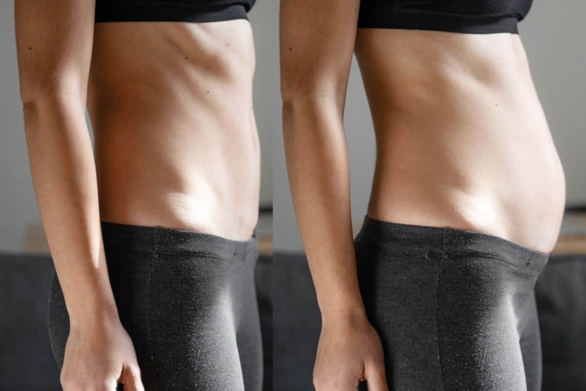 How long does diastasis recti take to improve Hampshire?