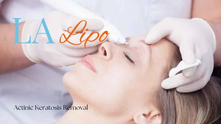 Woman receiving Actinic Keratosis Removal Treatment Hampshire