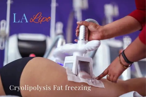 women getting fat freezing Hampshire