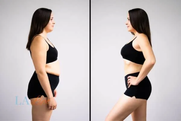 link between body image and mental health Hampshire