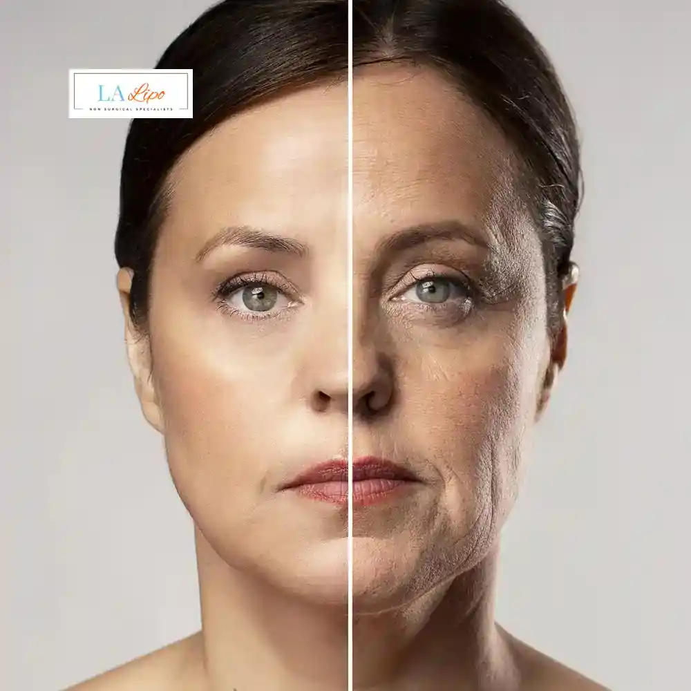 How Can You Tell If Non-Surgical Skin Tightening Is Right for You Hampshire?