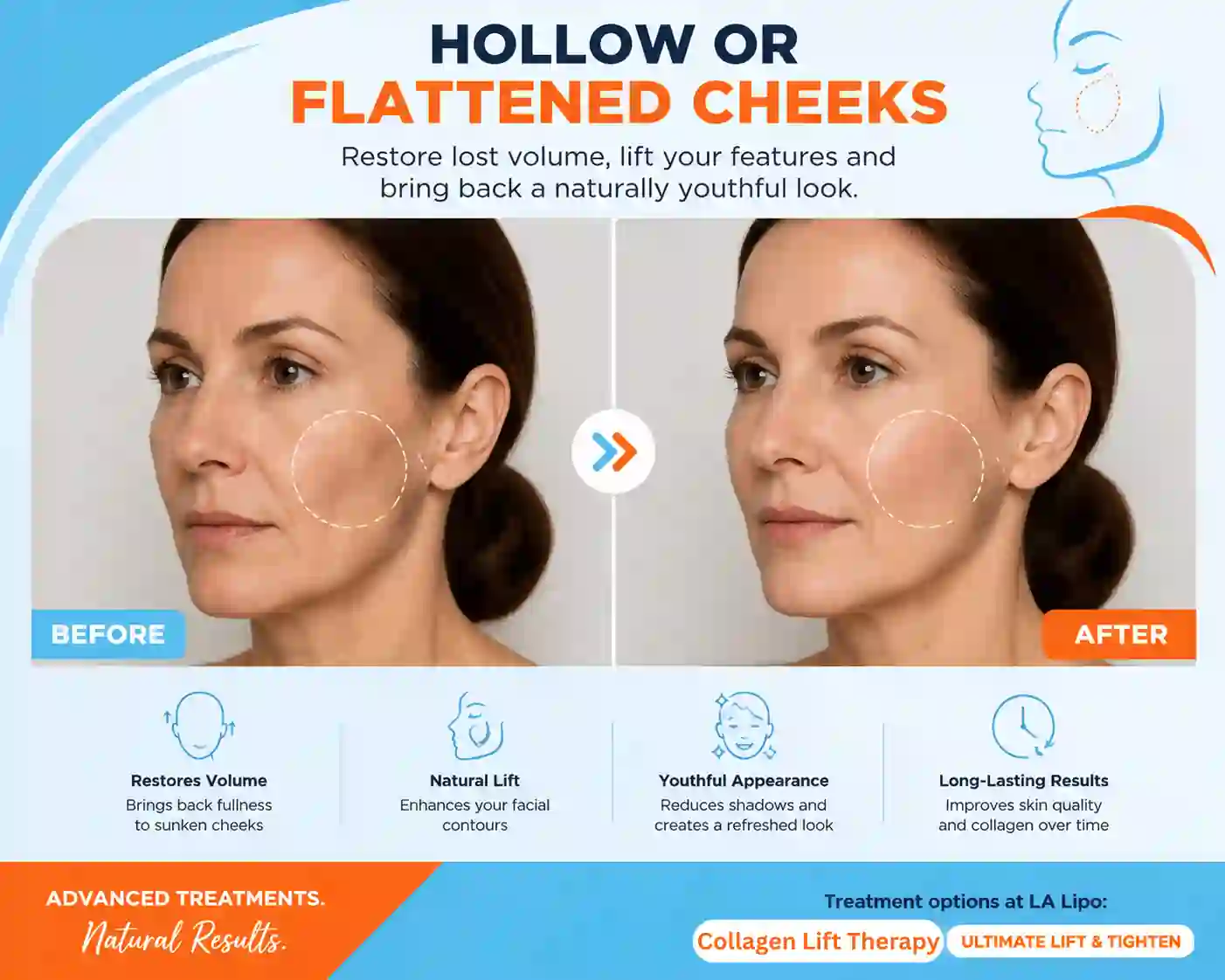 Sign #4: Hollow or Flattened Cheeks Hampshire
