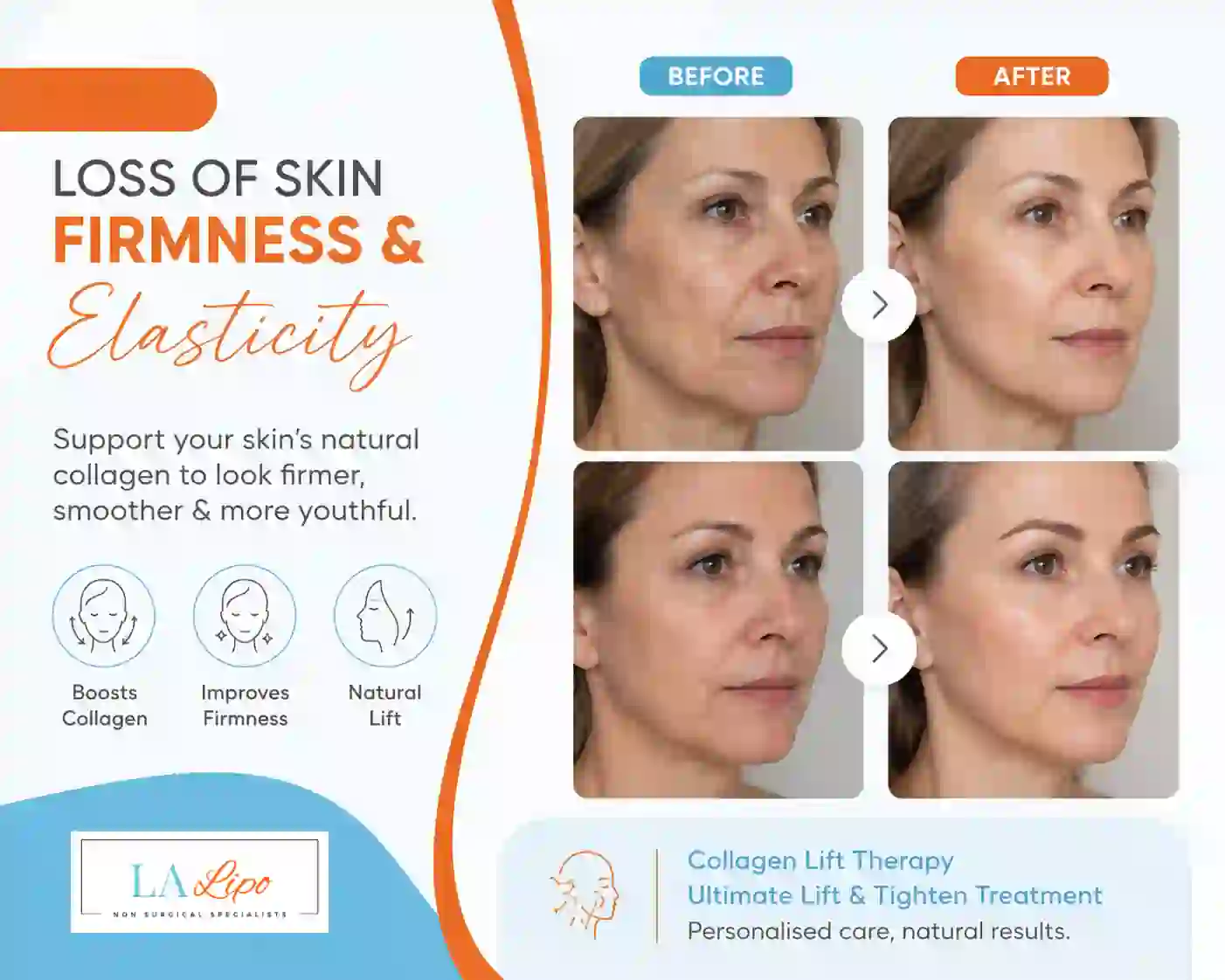 Sign #7: Loss of Skin Firmness and Elasticity Hampshire